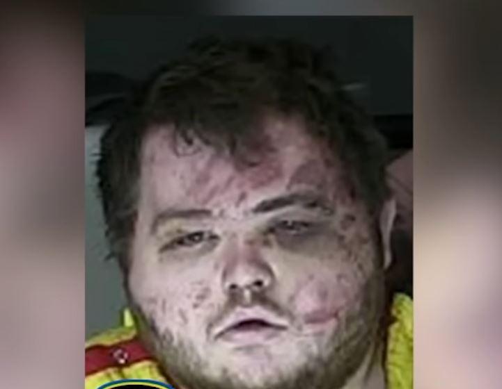 Bloodied & Bruised: Colorado Club Shooting Suspect Mugshots Released